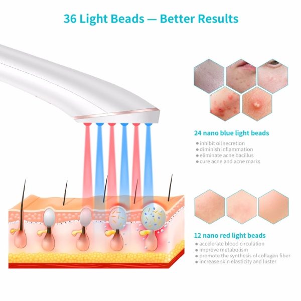 ⁦Acne Light Therapy Xpreen Wireless Rechargeable Light Acne Treatment Device Acne Clearing Eraser with Blue Light and Red Light⁩ - الصورة ⁦3⁩