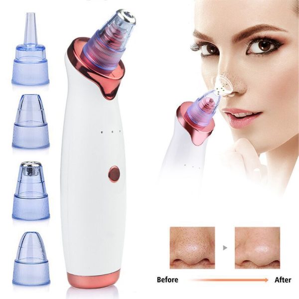 ⁦Acne Cleaner Beauty Equipment⁩ - الصورة ⁦2⁩