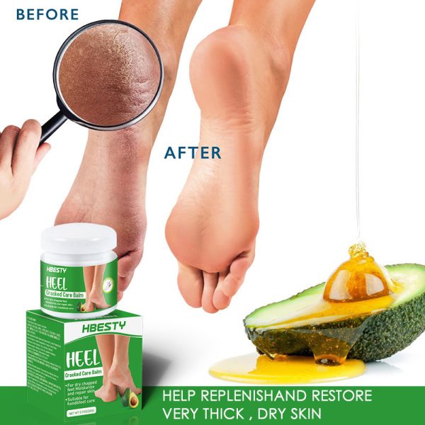 ⁦Avocado Heel Cracking Cream⁩ - الصورة ⁦4⁩
