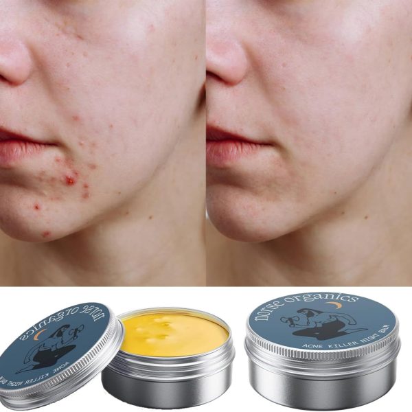 ⁦Acne Treatment Cream, Muscle Joint Skin Moisturizing Cream⁩ - الصورة ⁦3⁩